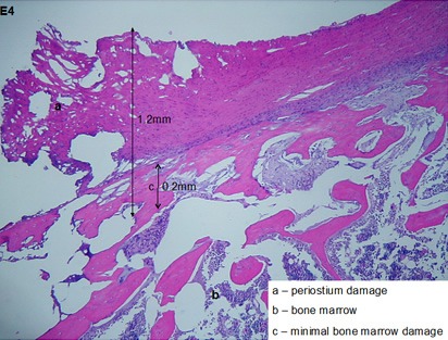 Figure 3A. In vivo porcine resection of sternum