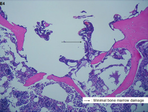 Figure 3B. In vivo resection of sternum in vivo porcine model minimal bone marrow damage (0.2mm)@12w, 5 liters/min